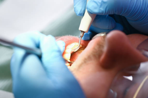 Best Urgent Dental Care for Toothache in Danville, CA