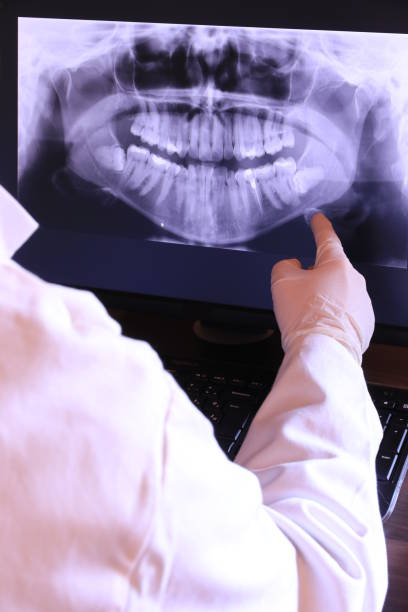 Best Emergency Dental Services for Seniors in Danville, CA