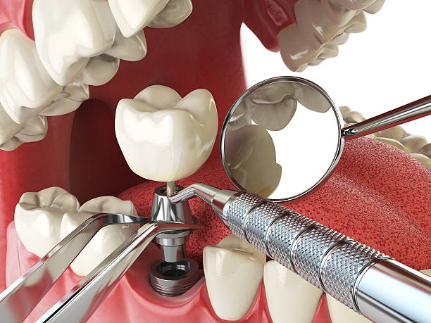 Best Emergency Cosmetic Dentistry in Danville, CA